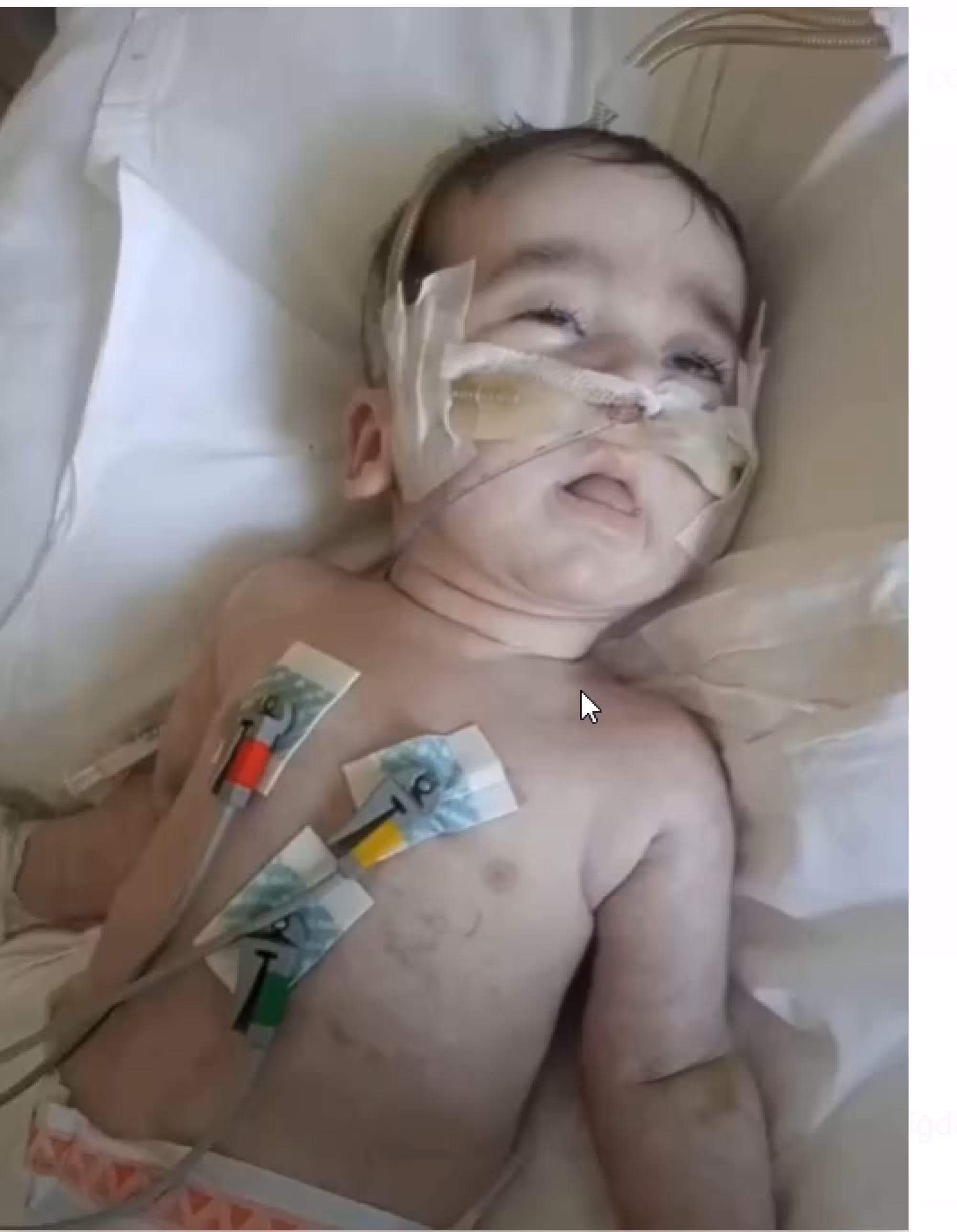 2-jährige Miray gegen die Leberzirrhose